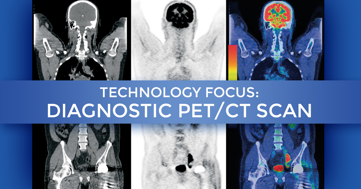 Technology Focus Diagnostic Petct Scan At Summit Cancer Centers