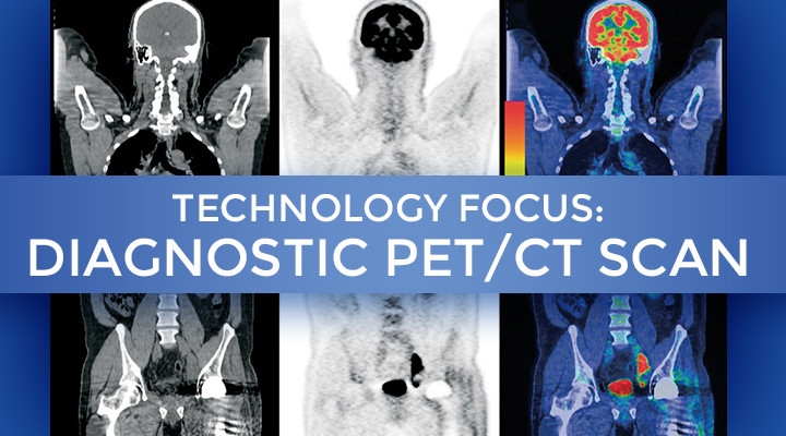 diagnostic pet/ct at summit cancer centers
