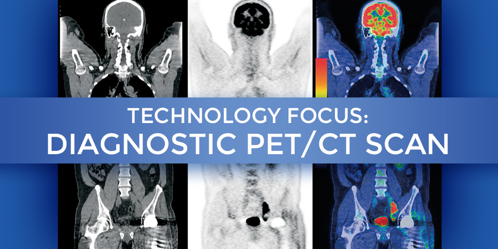 Technology Focus – Diagnostic PET/CT Scan at Summit Cancer